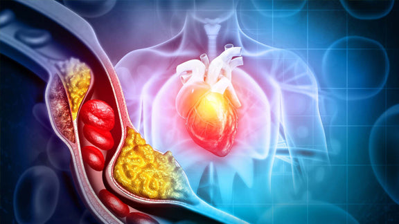 natural cholesterol control and heart health with artery plaque and blood flow illustration